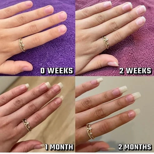 Nail Growth Serum(Rapid Growth)